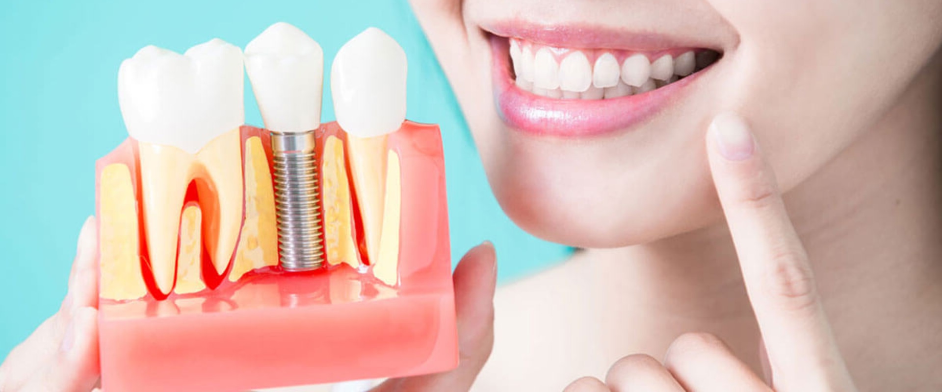 What is the disadvantage of dental implants?