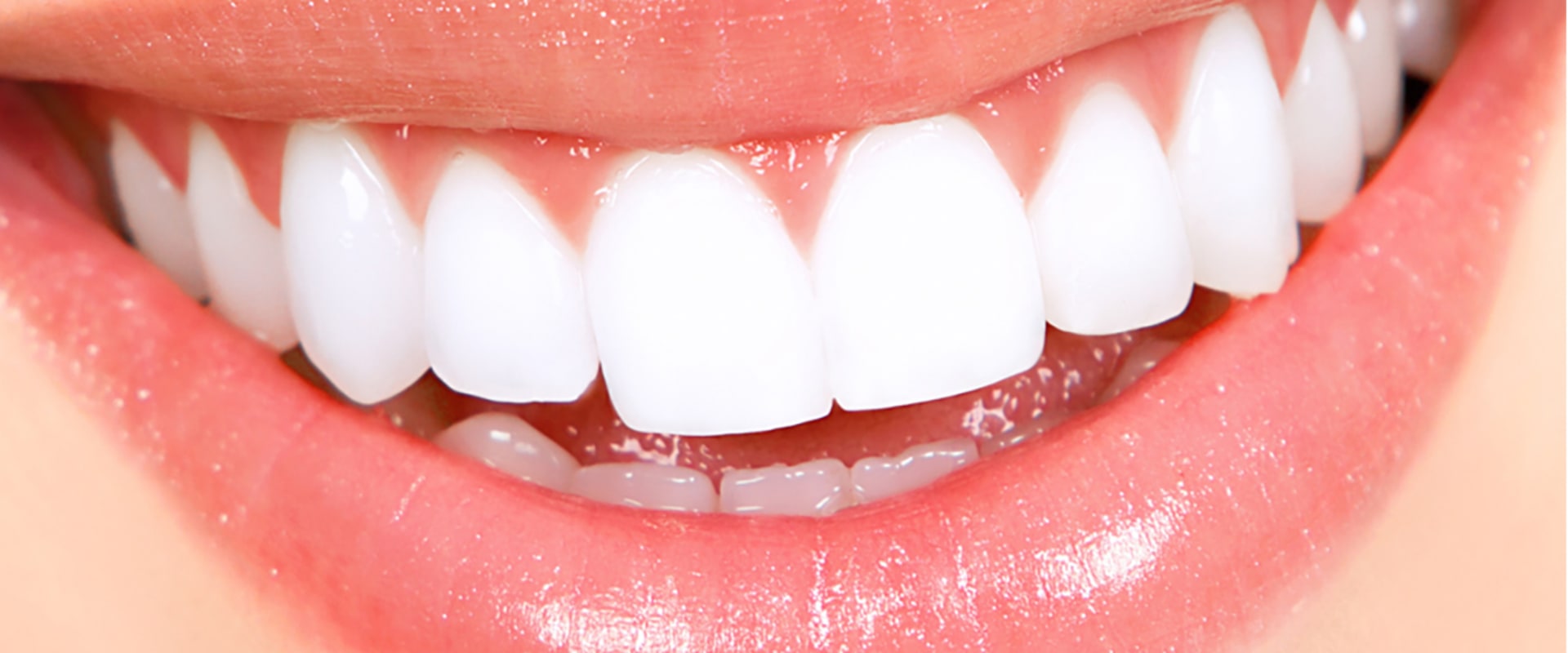 What is the cost of dental implants in India?