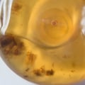 How do you know if your implants are making you sick?