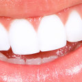 What is the cost of dental implants in India?