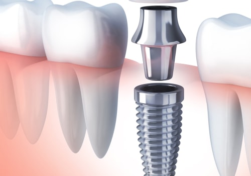 How much pain for dental implants?