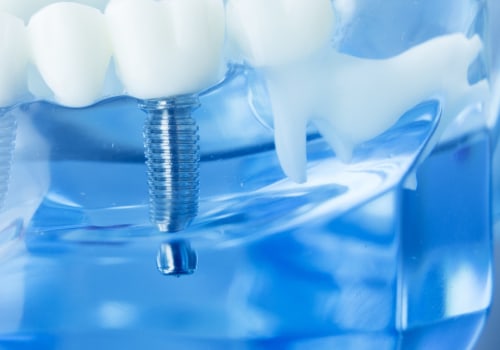Who is not suitable for dental implants?